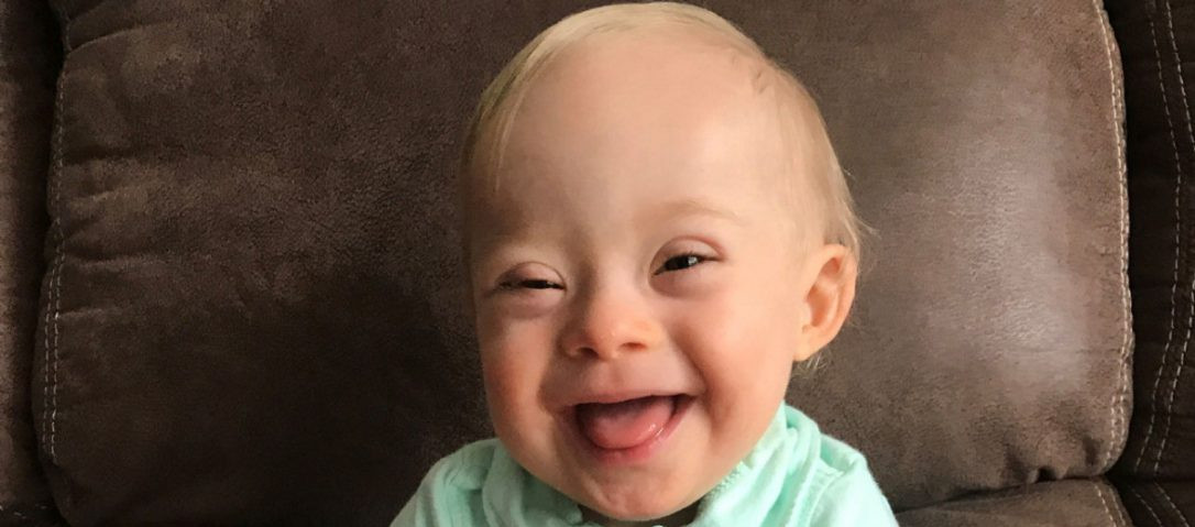 Gerber Down Syndrome ‘Spokesbaby of the Year’ May Help Start Changing Attitudes